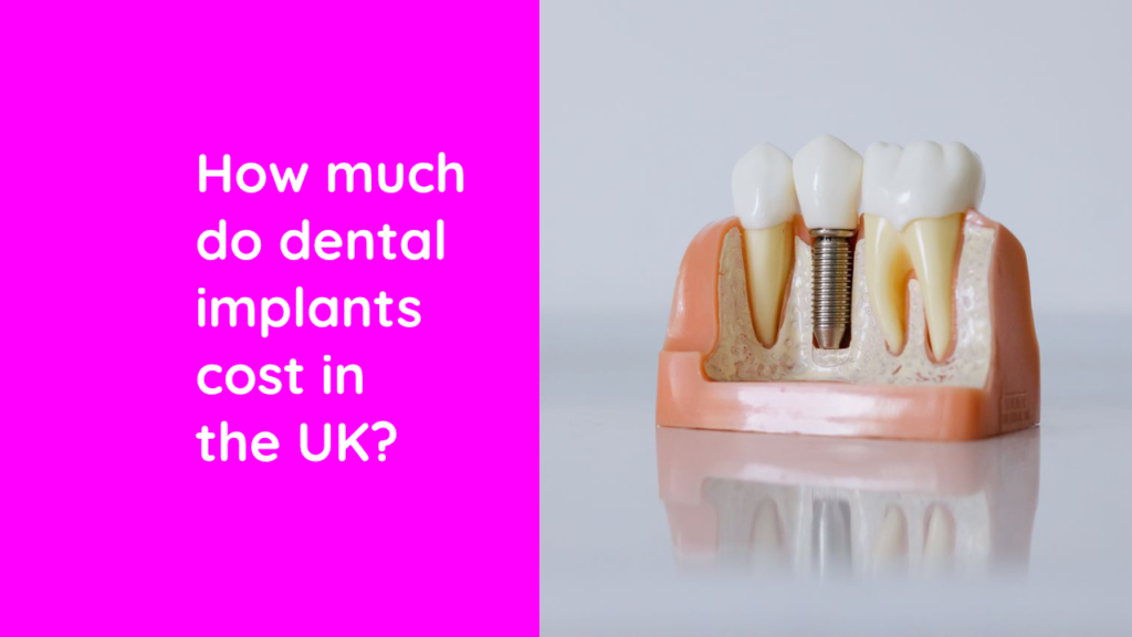 Cross-section dental model showing a single dental implant with a crown, placed between two natural teeth in the jawbone