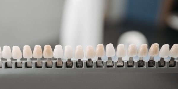 Dental shade guide used to match an implant crown to the colour of the surrounding teeth